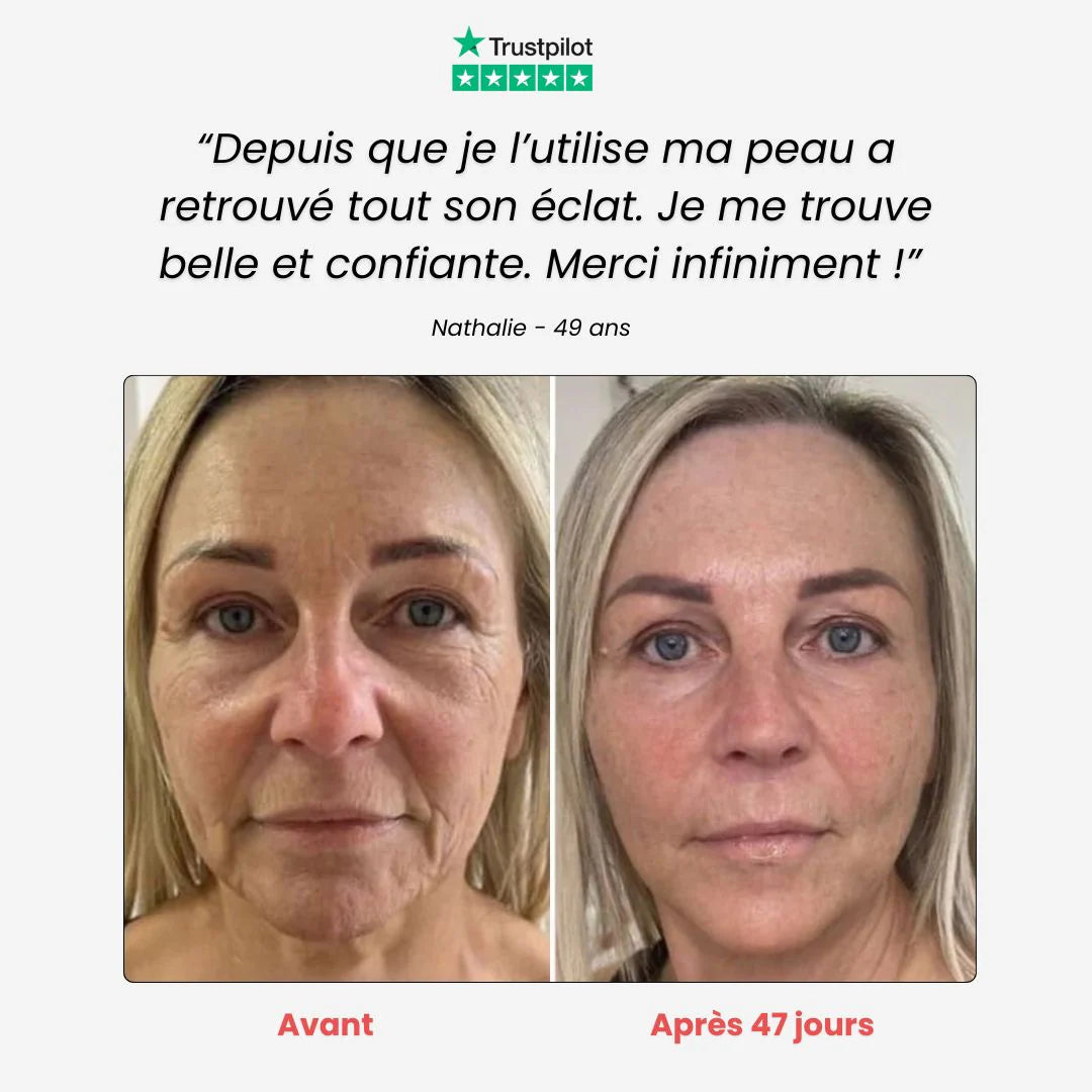SkinLume | Lifter LED 7-en-1 – Soin Raffermissant Visage & Cou