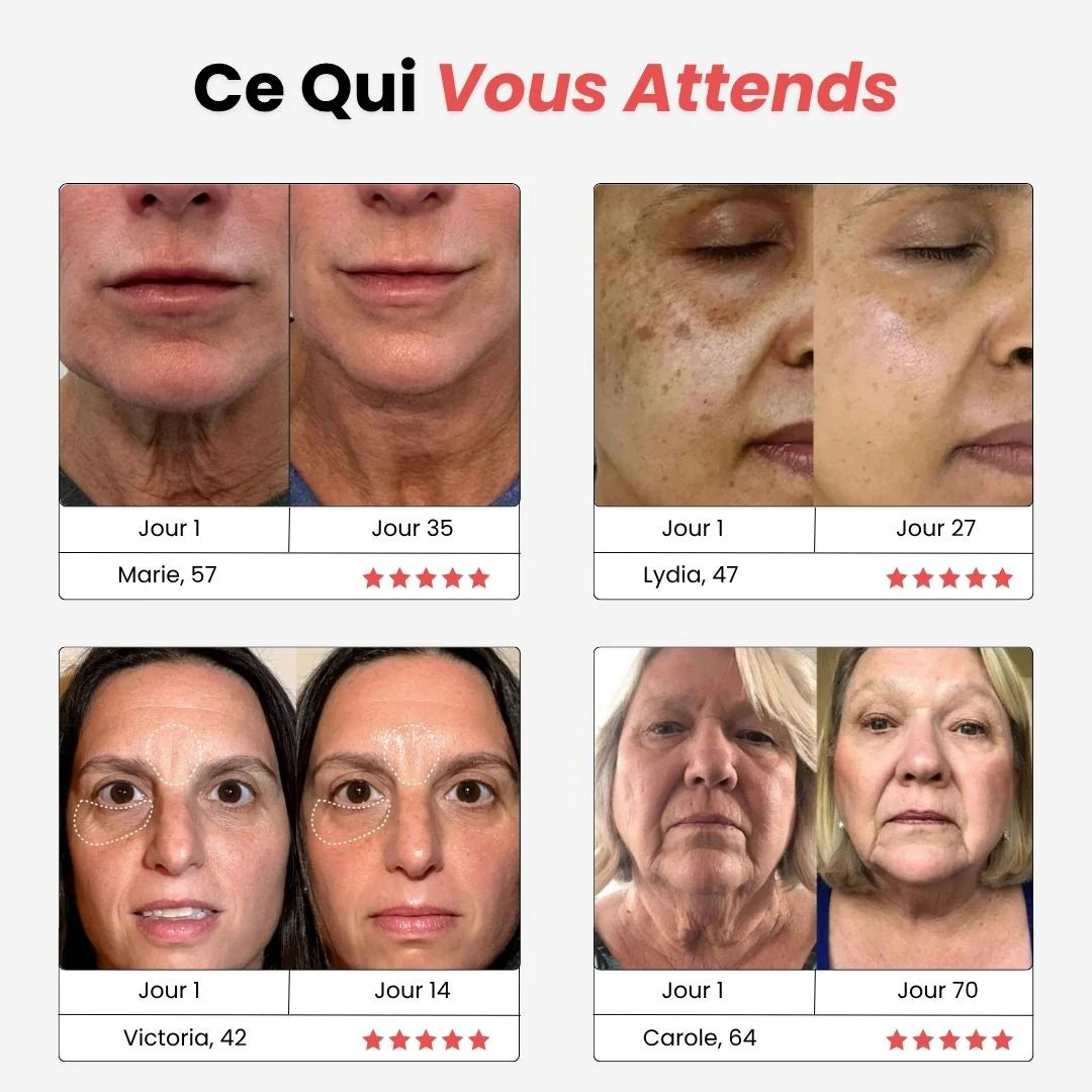 SkinLume | Lifter LED 7-en-1 – Soin Raffermissant Visage & Cou